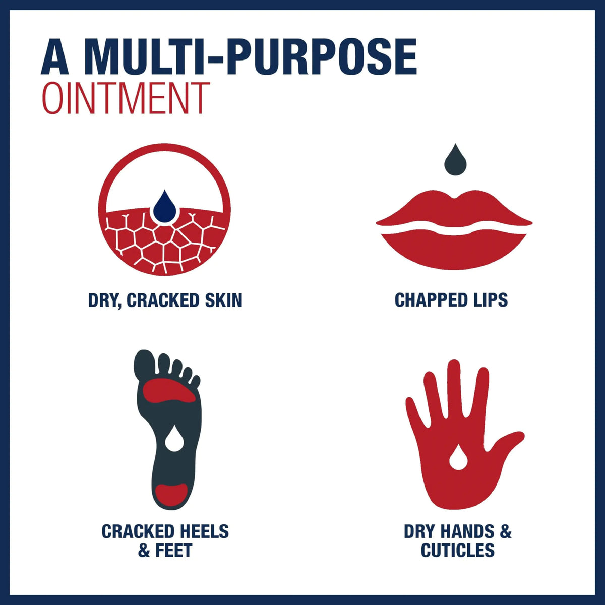 Aquaphor Healing Ointment, Advanced Therapy Skin Protectant, Dry Skin Body Moisturizer, Multi-Purpose Healing Ointment, for Dry, Cracked Skin &amp; Minor Cuts &amp; Burns, 14 Oz Jar